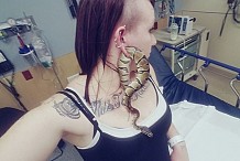 Un serpent coincé dans l'oreille, elle finit aux urgences